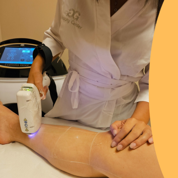 Epilday-LASER, epilazione progressivamente definitiva